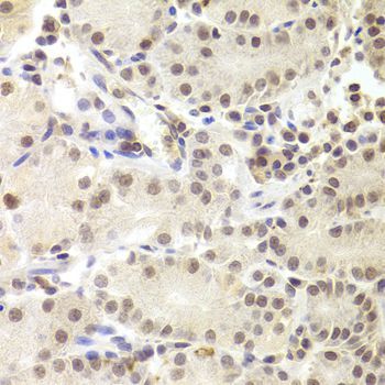 Immunohistochemistry - PRPF3 Polyclonal Antibody (144-05482)