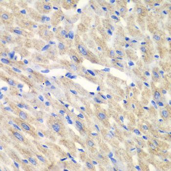 Immunohistochemistry - CARS antibody (144-06540)