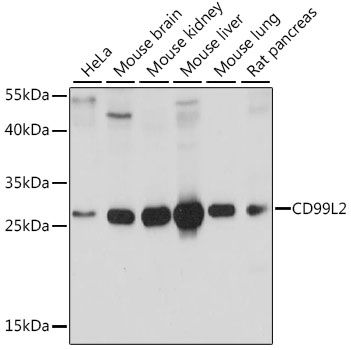 Western blot - CD99L2 antibody (144-015907)