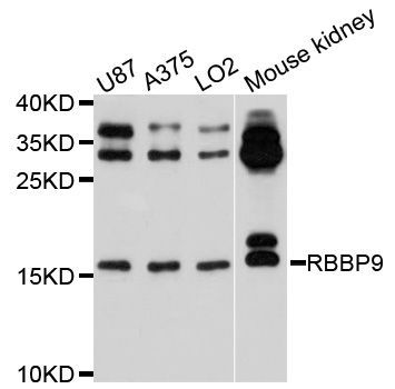 Western blot - RBBP9 antibody (144-04451)