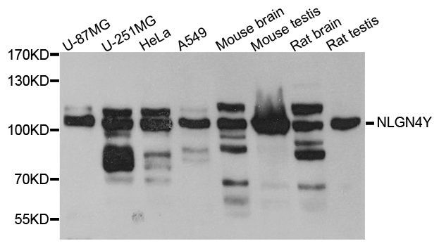 Western blot - NLGN4Y antibody (144-04513)