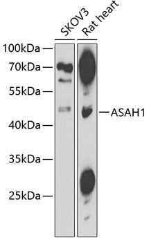 Western blot