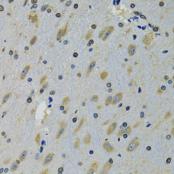 Immunohistochemistry - RPS12 antibody (144-05890)