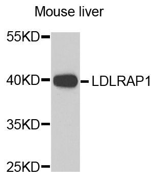 Western blot - LDLRAP1 Polyclonal Antibody (144-07093)