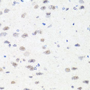 Immunohistochemistry - [KO Validated] CHD1 Polyclonal Antibody (144-07883)