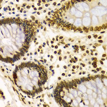 Immunohistochemistry - Lamin A/C Polyclonal Antibody (144-00249)