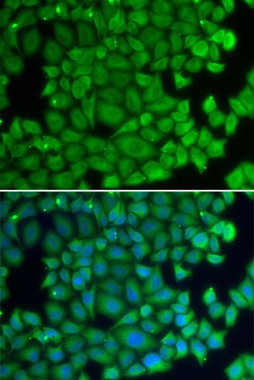 Immunofluorescence - HSPB2 antibody (144-02350)