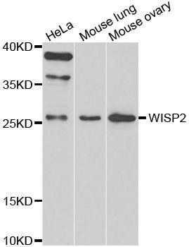 Western blot - WISP2 antibody (144-07456)