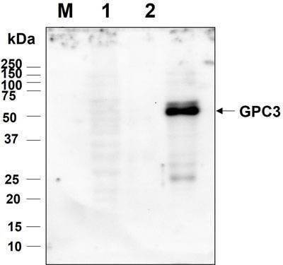 Western blot