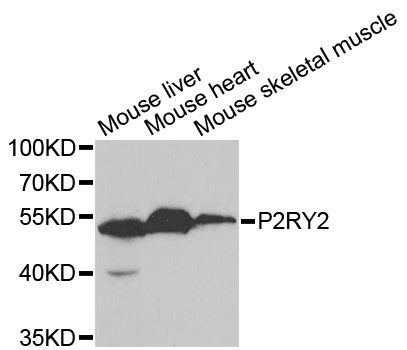 Western blot - P2RY2 Polyclonal Antibody (144-05779)
