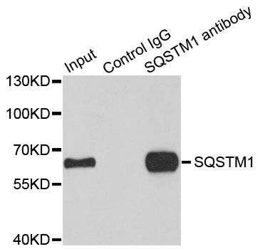 Immunofluorescence - SQSTM1 Polyclonal Antibody (144-011483)