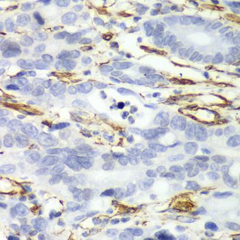 Immunohistochemistry - CALD1 antibody (144-05366)