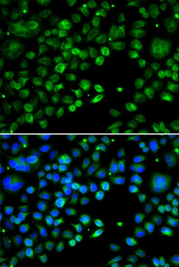 Immunofluorescence - TXNDC5 antibody (144-014152)
