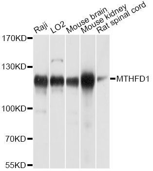 Western blot - MTHFD1 antibody (144-08661)