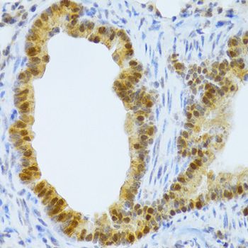 Immunohistochemistry - TAF1C Polyclonal Antibody (144-06759)
