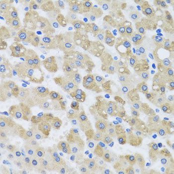 Immunohistochemistry - SNAP29 antibody (144-04290)