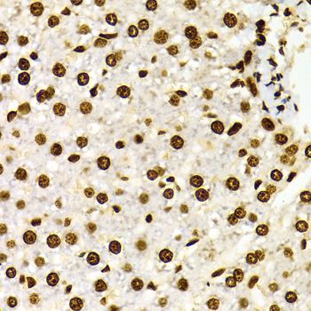 Immunohistochemistry - DiMethyl-Histone H3-K27 pAb (144-02362)