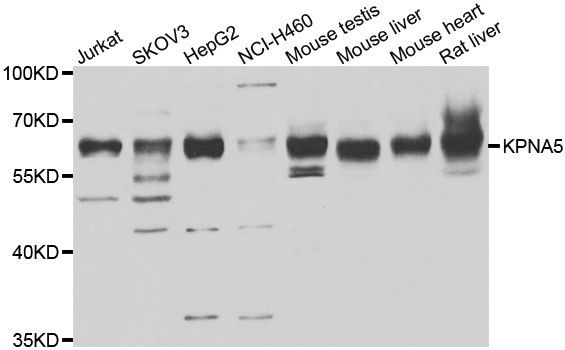 Western blot - KPNA5 antibody (144-07331)