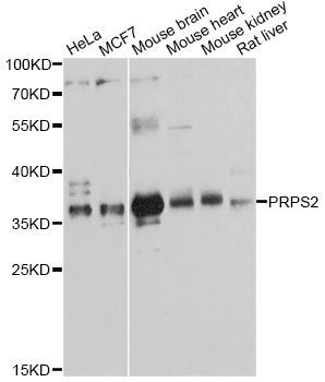 Western blot - PRPS2 antibody (144-012644)