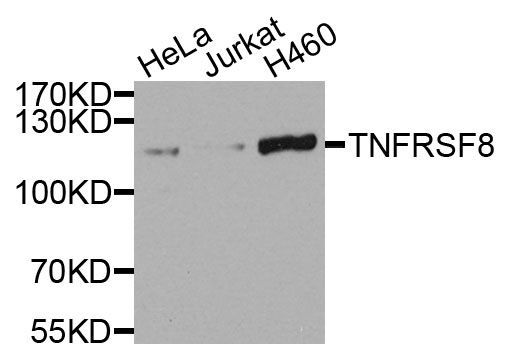 Western blot - TNFRSF8 Polyclonal Antibody (144-07651)