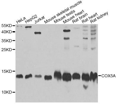 Western blot - COX5A Polyclonal Antibody (144-06437)