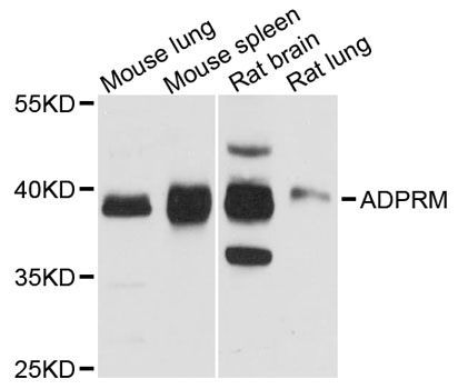 Western blot - ADPRM antibody (144-12883)