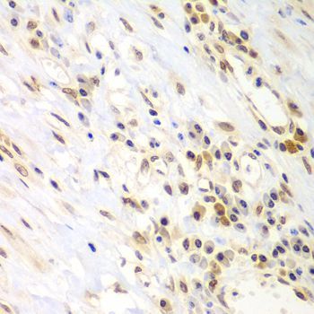 Immunohistochemistry - LHX4 antibody (144-08072)
