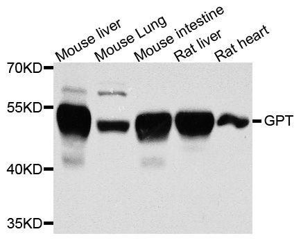 Western blot - GPT antibody (144-02814)
