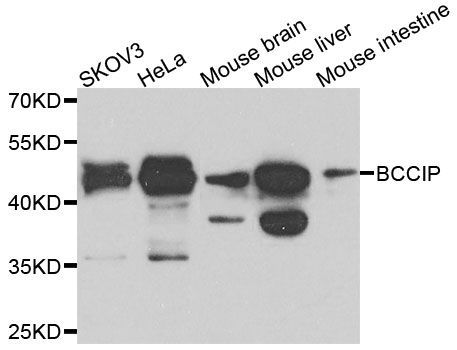 Western blot - BCCIP Polyclonal Antibody (144-08586)
