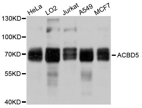 Western blot - ACBD5 Polyclonal Antibody (144-010595)