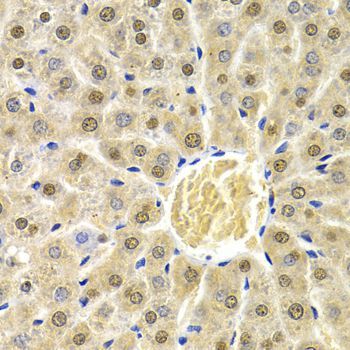 Immunohistochemistry - RAD9A Polyclonal Antibody (144-01890)