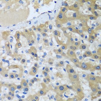 Immunohistochemistry - XPC Polyclonal Antibody (144-08354)