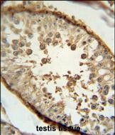 IHC-P