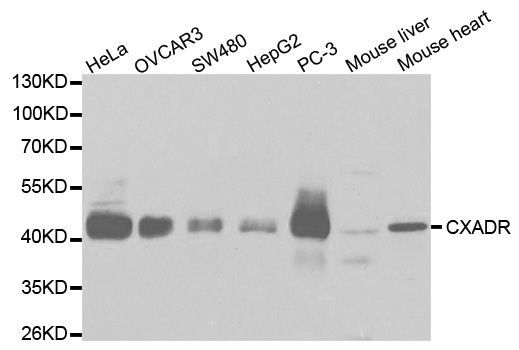 Western blot - CXADR antibody (144-01822)