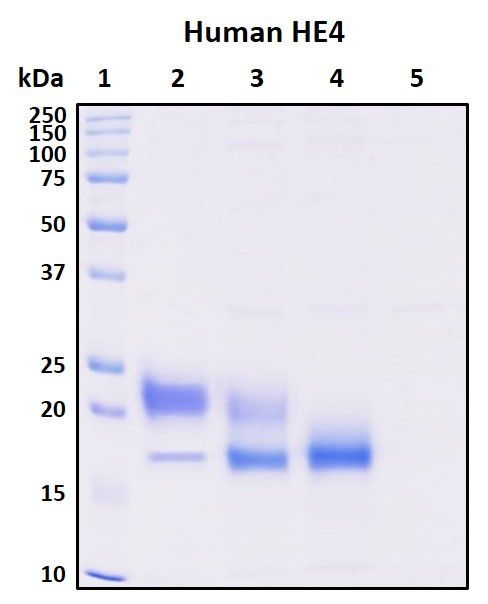 SDS-PAGE