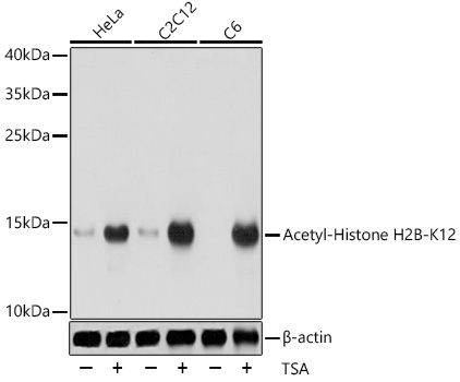 Western blot