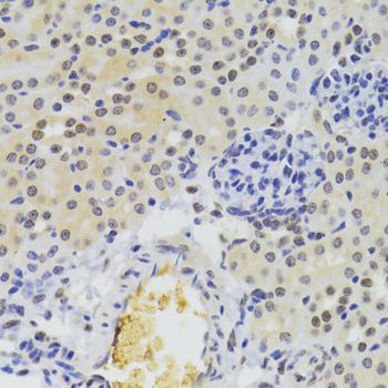 Immunohistochemistry - HNRNPA1 Polyclonal Antibody (144-07491)