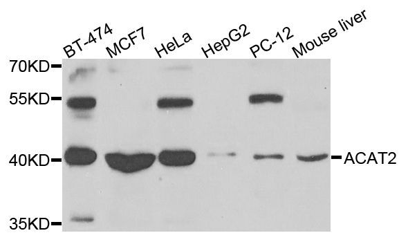 Western blot - ACAT2 antibody (144-07866)