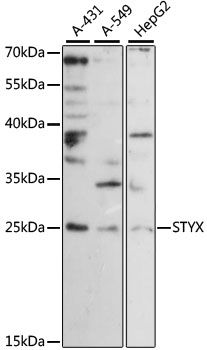 Western blot