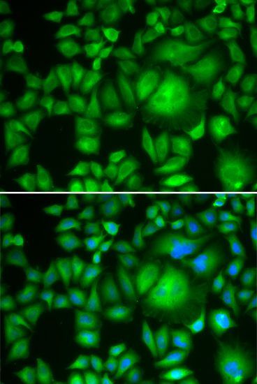 Immunofluorescence - CBR1 Polyclonal Antibody (144-05446)