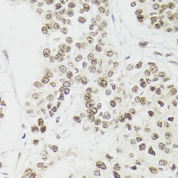 Immunohistochemistry - EDF1 Polyclonal Antibody (144-02283)