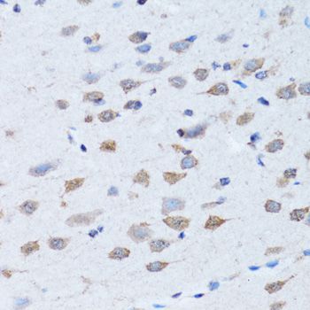 Immunohistochemistry - LDLRAP1 Polyclonal Antibody (144-07093)