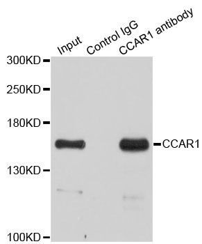 Immunoprecipitation - 3ug CCAR1 antibody (144-06334)
