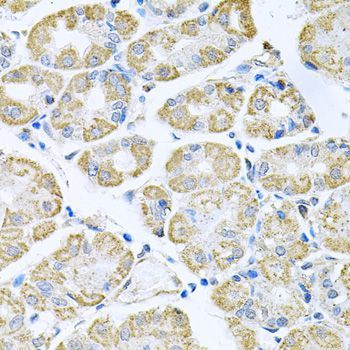 Immunohistochemistry - TNFRSF10A Polyclonal Antibody (144-06267)