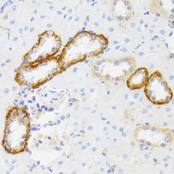 Immunohistochemistry - MYO5A antibody (144-09830)