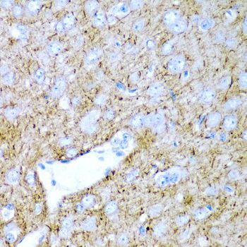 Immunohistochemistry - PTGDS antibody (144-01889)