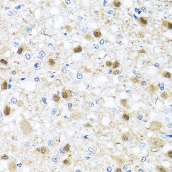 Immunohistochemistry - ZBTB17 antibody (144-08463)