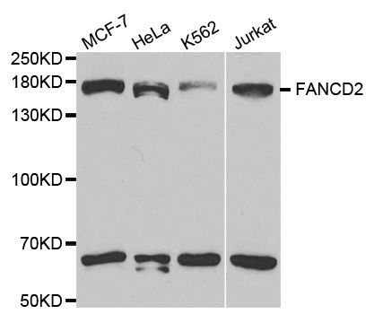 Western blot - FANCD2 Polyclonal Antibody (144-02072)