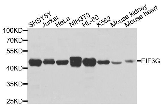 Western blot - EIF3G Polyclonal Antibody (144-04240)