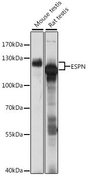 Western blot - ESPN antibody (144-015908)